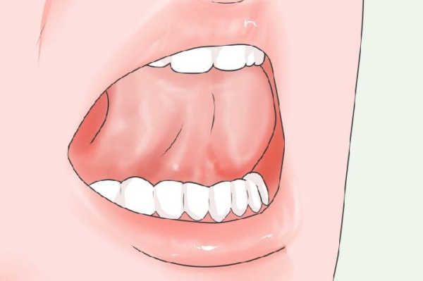 Thực hiện các bài tập đẩy răng để khắc phục tình trạng răng ngắn