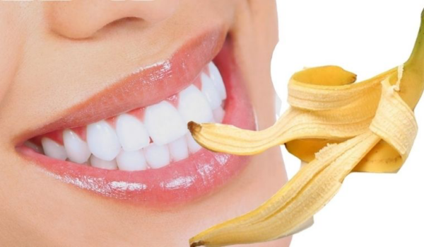 Phương pháp loại bỏ cao răng từ vỏ chuối