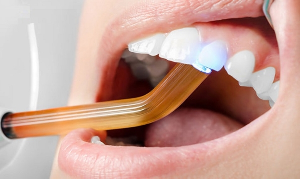 Trám răng đóng vai trò quan trọng trong điều trị và bảo vệ răng bị thiểu sản men
