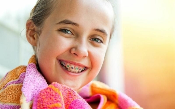 Vì sao nên niềng răng cho trẻ càng sớm càng tốt?