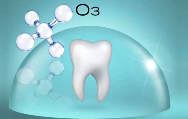 Ứng dụng của ozon trong điều trị sâu răng