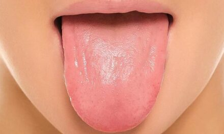 Hình ảnh 1: Lưỡi người lớn có màu hồng, bề mặt nhẵn bóng, không tổn thương