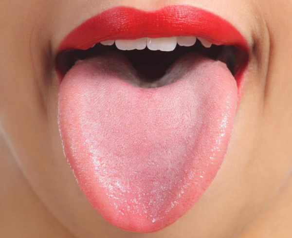 Hình ảnh 4: Bề mặt lưỡi không có mảng trắng hay các vết bất thường.