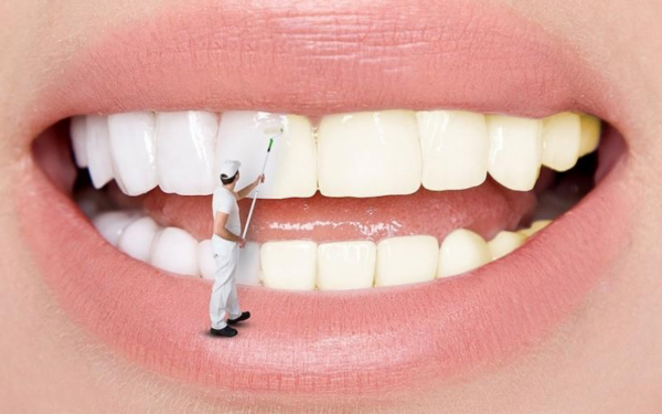 Lớp men răng đóng vai trò trong việc bảo vệ ngà răng