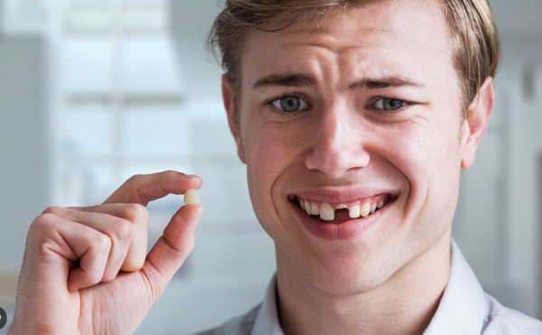 Răng bị gãy có thể do nhiều nguyên nhân khác nhau