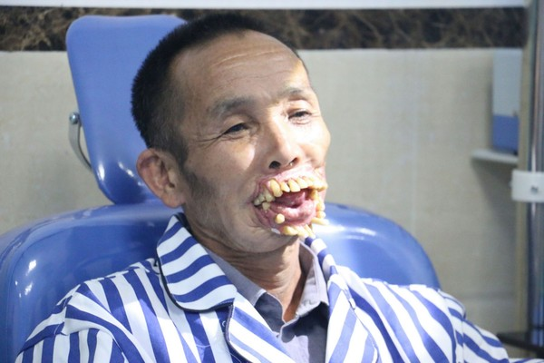 Ông Wu Xiuyou và hàm răng của ông