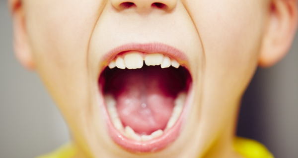 Quá trình mọc và thay răng của trẻ em theo từng giai đoạn tuổi tác