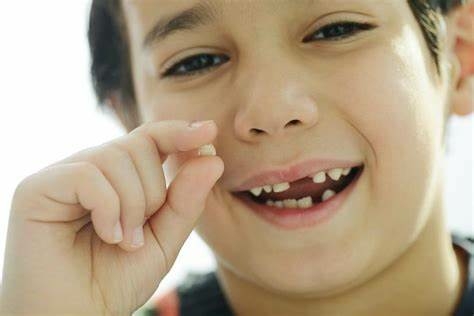 Độ tuổi 14 là giai đoạn cuối của quá trình thay răng ở trẻ em