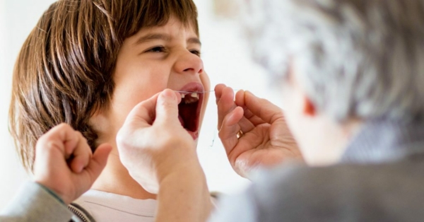 Nhổ răng chỉ được khuyến cáo thực hiện khi tình trạng sâu răng đã quá nặng
