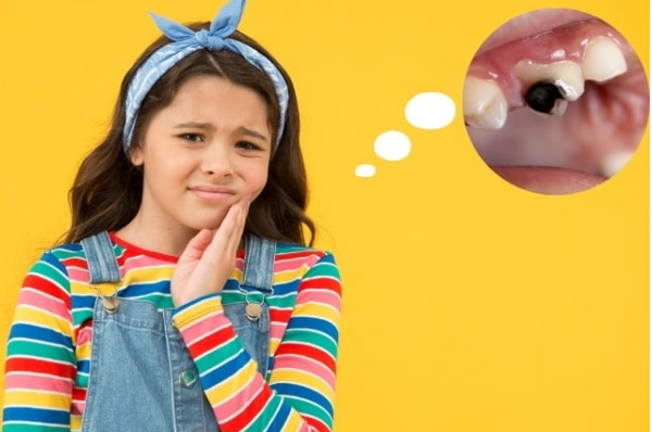 Hậu quả của sâu răng hàm ở trẻ có thể vô cùng nghiêm trọng nếu không được phát hiện và can thiệp điều trị kịp thời