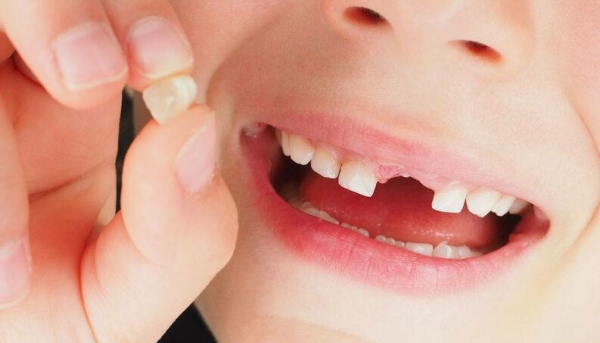 Có nên giữ lại răng sau khi nhổ không?