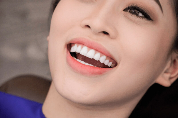Cầu răng che phủ triệt để thiếu hụt răng “trả” lại nụ cười đầy đặn cho bạn