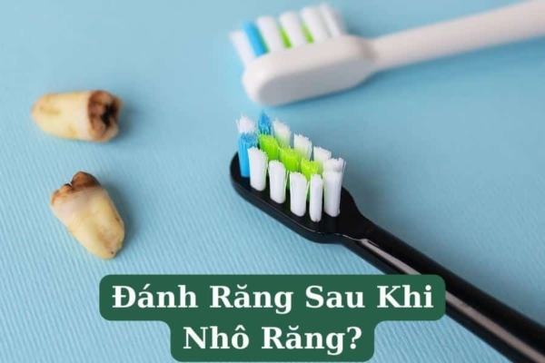 Cách đánh răng đúng cách sau khi nhổ