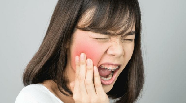 Khi răng đang viêm nhiễm thì không nên vội vàng nhổ ngay