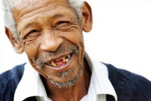 Do các quá trình sinh lý tự nhiên khi tuổi cao, người già rất dễ bị mục chân răng