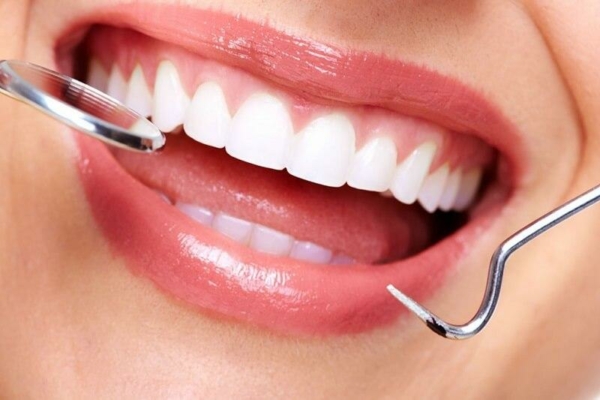 Quy trình niềng răng 1 hàm gồm những bước tương tự như quy trình niềng răng toàn hàm