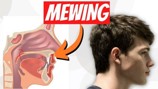 Mewing là phương pháp làm đẹp khuôn mặt bằng cách sử dụng lực từ lưỡi để ấn lên vòm miệng