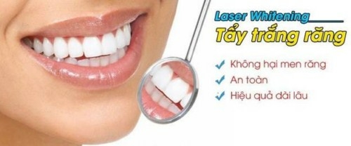 Laser Whitening mang lại hiệu quả tẩy trắng răng nhanh chóng và duy trì lâu dài