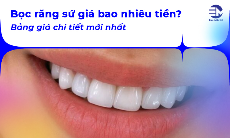 Bọc răng sứ giá bao nhiêu tiền? Bảng giá chi tiết mới nhất