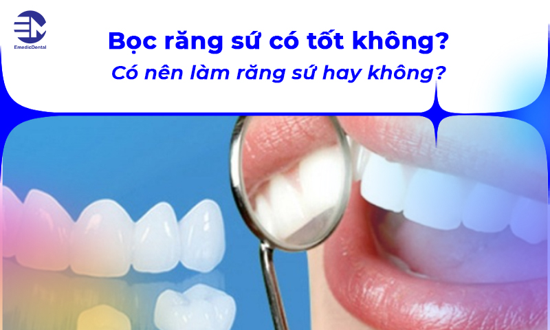 Bọc răng sứ có tốt không? Có nên làm răng sứ hay không?