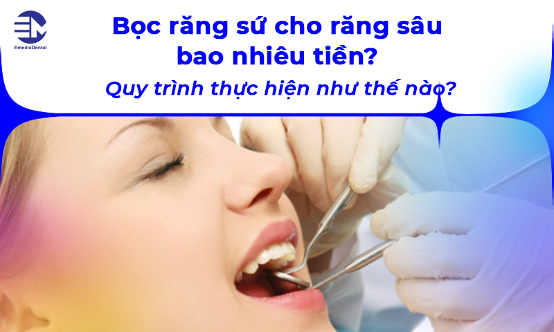 Bọc răng sứ cho răng sâu bao nhiêu tiền? Quy trình thực hiện như thế nào?