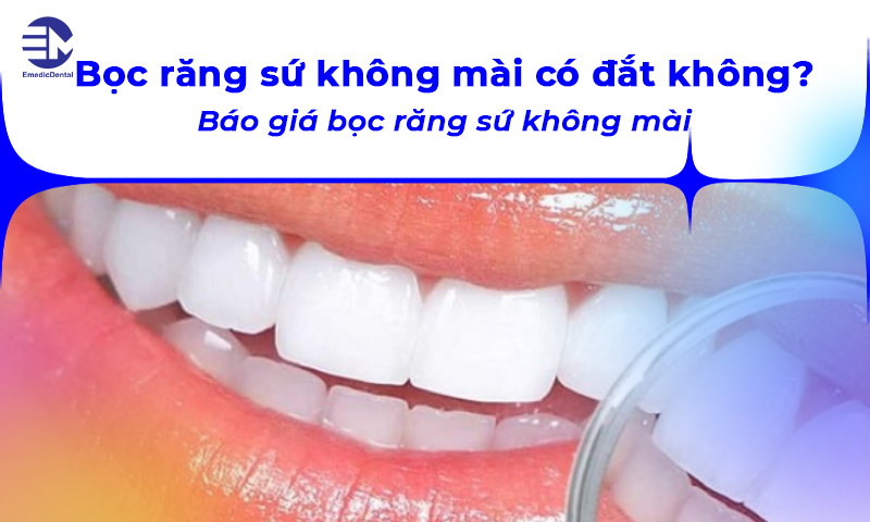 Bọc răng sứ không mài có đắt không? Báo giá bọc răng sứ không mài