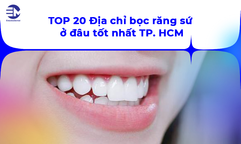 TOP 20 Địa chỉ bọc răng sứ ở đâu tốt nhất TPHCM