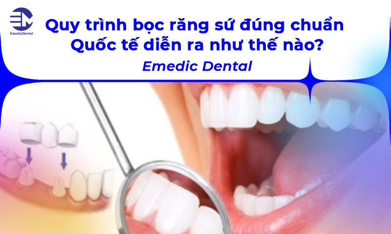 Quy trình bọc răng sứ đúng chuẩn Quốc tế diễn ra như thế nào? Emedic Dental