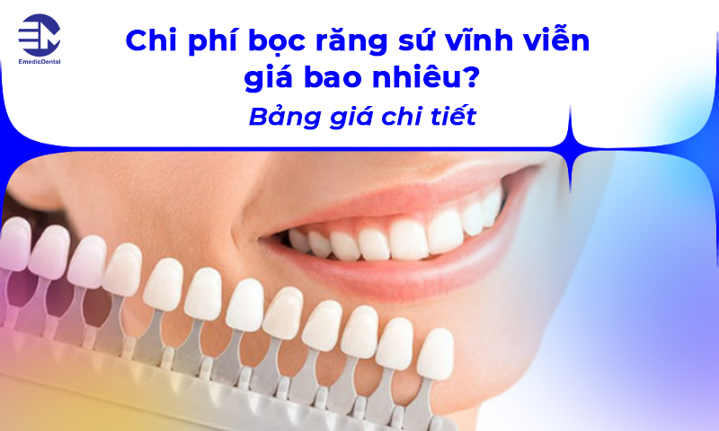 Chi phí bọc răng sứ vĩnh viễn giá bao nhiêu? Bảng giá chi tiết