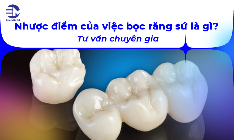 Nhược điểm của việc bọc răng sứ là gì? Tư vấn chuyên gia