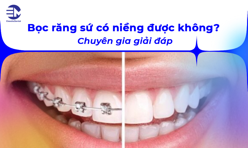 Bọc răng sứ có niềng được không? Chuyên gia giải đáp