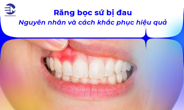 Răng bọc sứ bị đau: Nguyên nhân và cách khắc phục hiệu quả