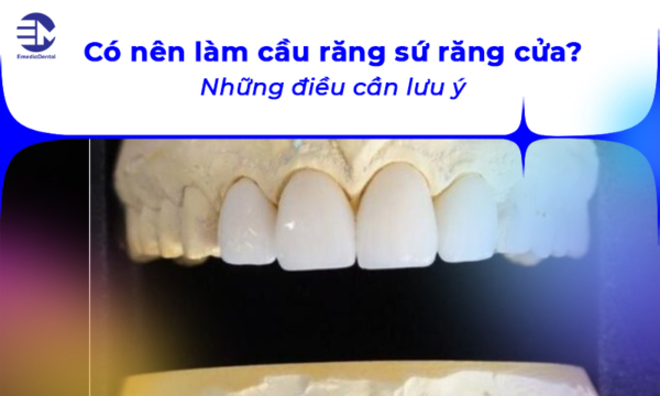 Có nên làm cầu răng sứ răng cửa? Những điều cần lưu ý