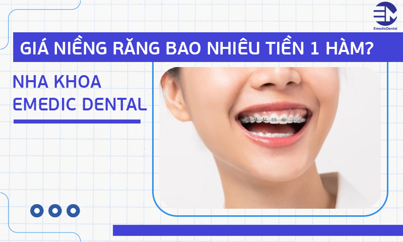 Giá niềng răng bao nhiêu tiền 1 hàm? Nha Khoa Emedic Dental