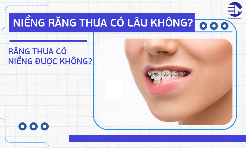 Niềng răng thưa có lâu không? Răng thưa có niềng được không?