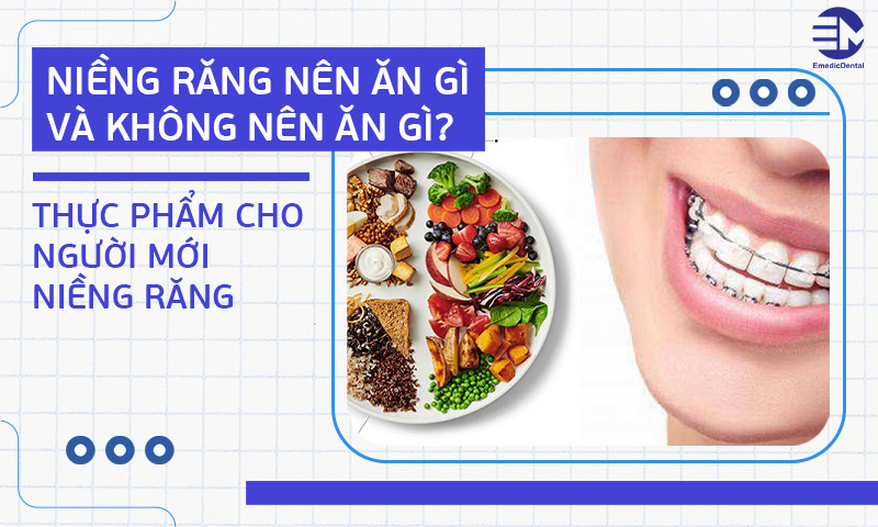 Niềng răng nên ăn gì và không nên ăn gì? Thực phẩm cho người mới niềng răng