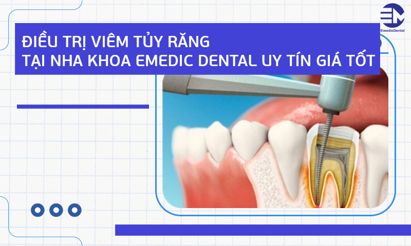 Điều trị viêm tủy răng tại Nha khoa Emedic Dental uy tín giá tốt
