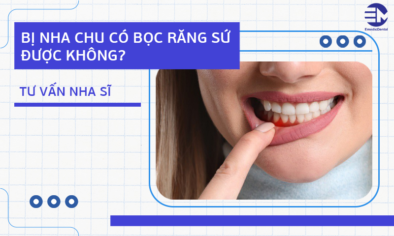 Bị nha chu có bọc răng sứ được không? Tư vấn Nha Sĩ