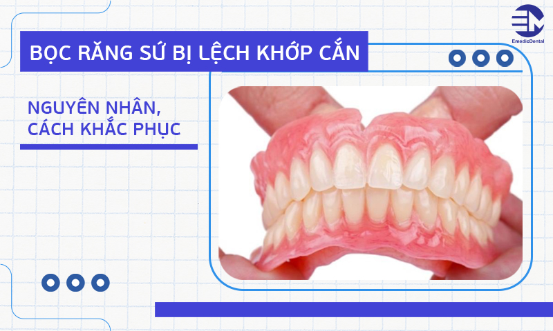 Bọc răng sứ bị lệch khớp cắn: Nguyên nhân, cách khắc phục