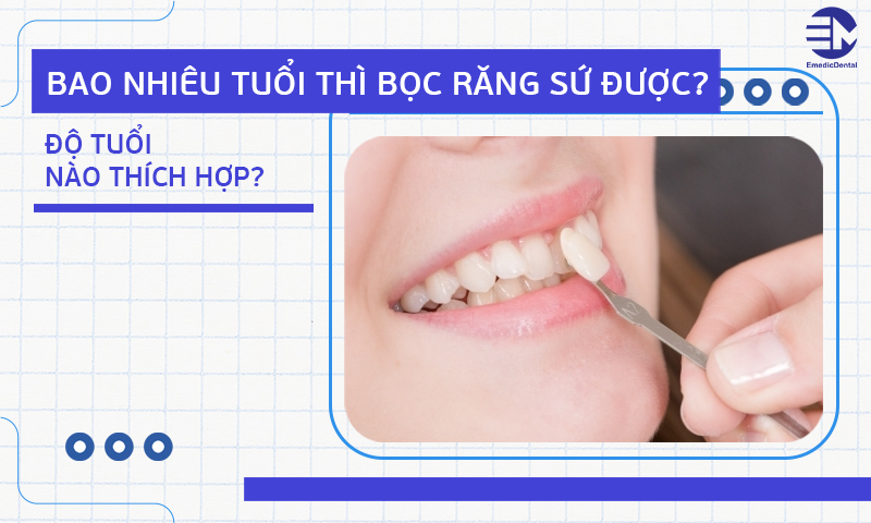 Bao nhiêu tuổi thì bọc răng sứ được? Độ tuổi nào thích hợp?