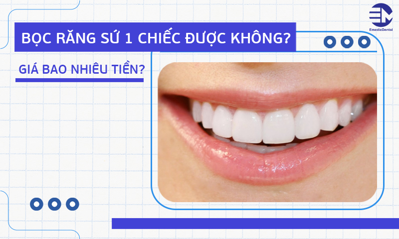 Bọc răng sứ 1 chiếc được không? Giá bao nhiêu tiền?