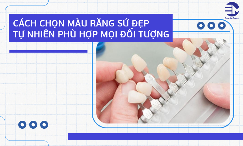 Cách chọn màu răng sứ đẹp tự nhiên phù hợp mọi đối tượng