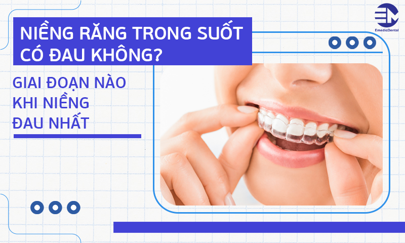 Niềng răng trong suốt có đau không? Giai đoạn nào khi niềng đau nhất?