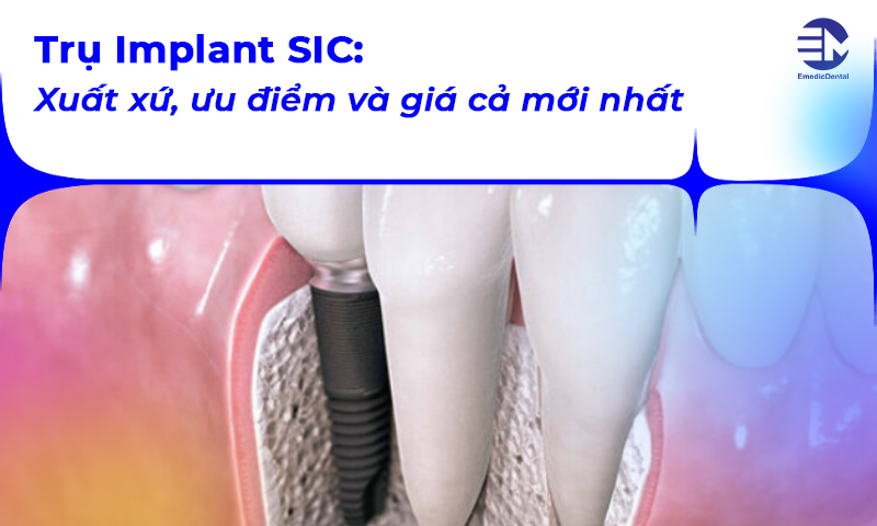 Trụ Implant SIC: Xuất xứ, ưu điểm và giá cả mới nhất