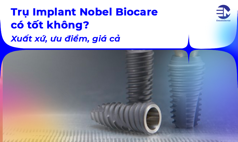 Trụ Implant Nobel Biocare có tốt không? Xuất xứ, ưu điểm, giá cả