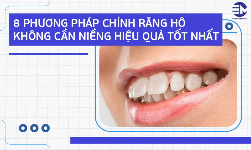 8 Phương pháp chỉnh răng hô không cần niềng hiệu quả tốt nhất