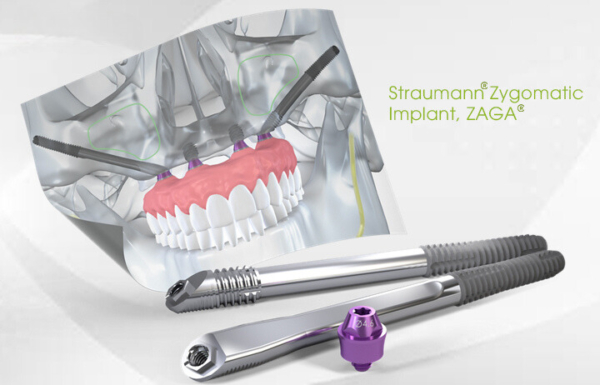 Trụ Implant Straumann Zygomatic