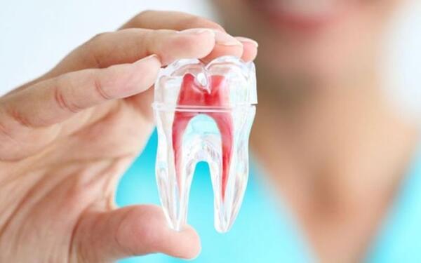Lấy tủy bọc răng sứ giá bao nhiêu? Có nên lấy tủy trước khi làm răng sứ