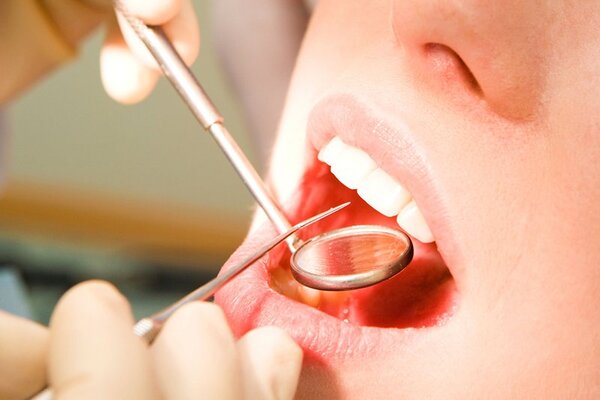 Nếu bạn chọn nha khoa kém an toàn thì nguy cơ biến chứng rất lớn - nhược điểm của việc bọc răng sứ