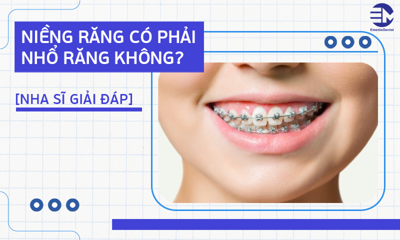 niềng răng có phải nhổ răng không